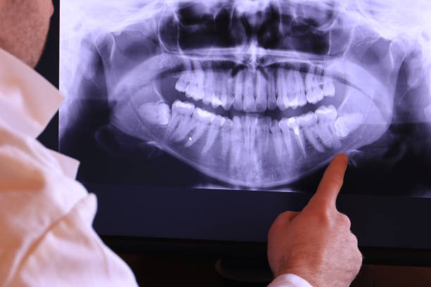 Best Emergency Root Canal Treatment in Rothsville, PA